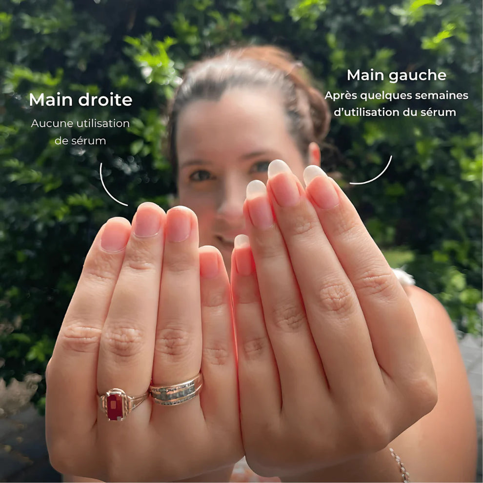 Huile Revitalisante pour Cuticules au Citron 🍋 – Ongles forts, brillants et nourris + 1 Offerte !