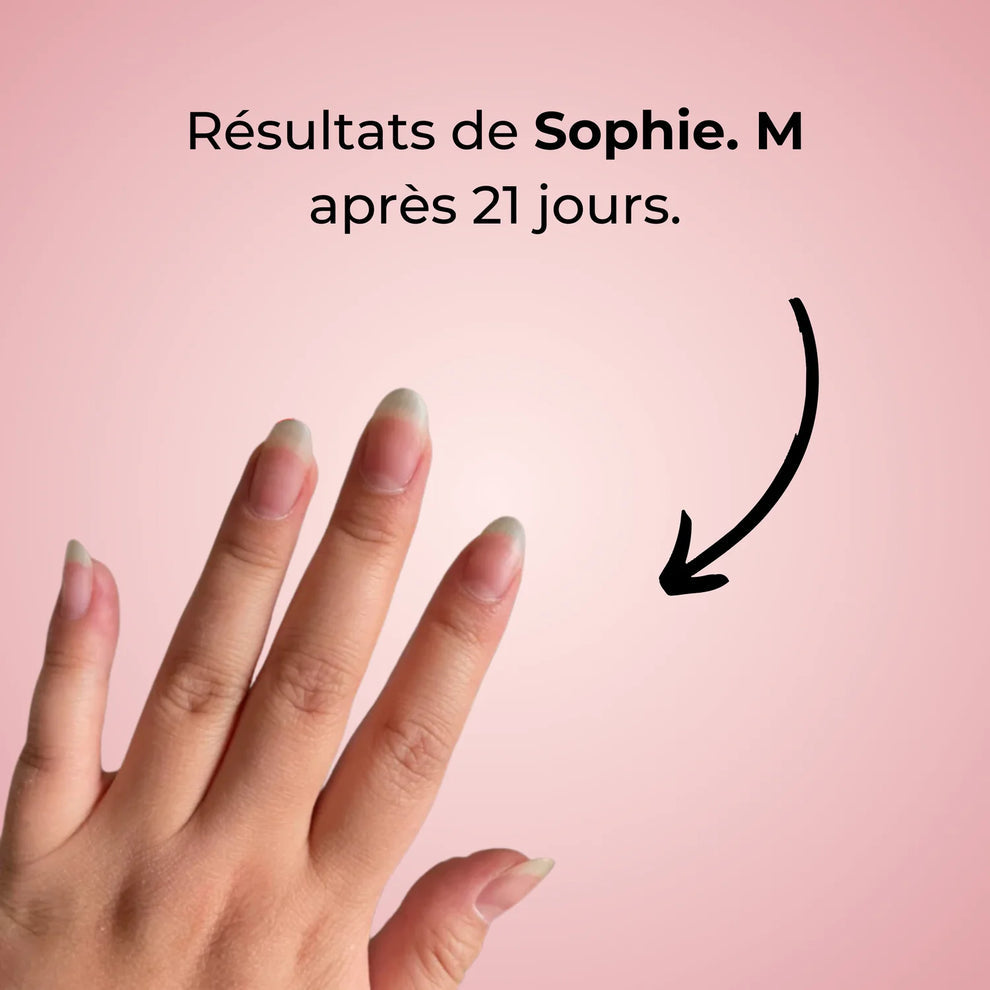 Huile Revitalisante pour Cuticules au Citron 🍋 – Ongles forts, brillants et nourris + 1 Offerte !
