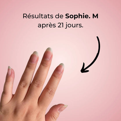 Huile Revitalisante pour Cuticules au Citron 🍋 – Ongles forts, brillants et nourris + 1 Offerte !